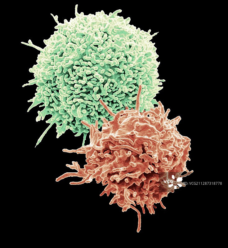 T淋巴细胞扫描电镜图图片素材