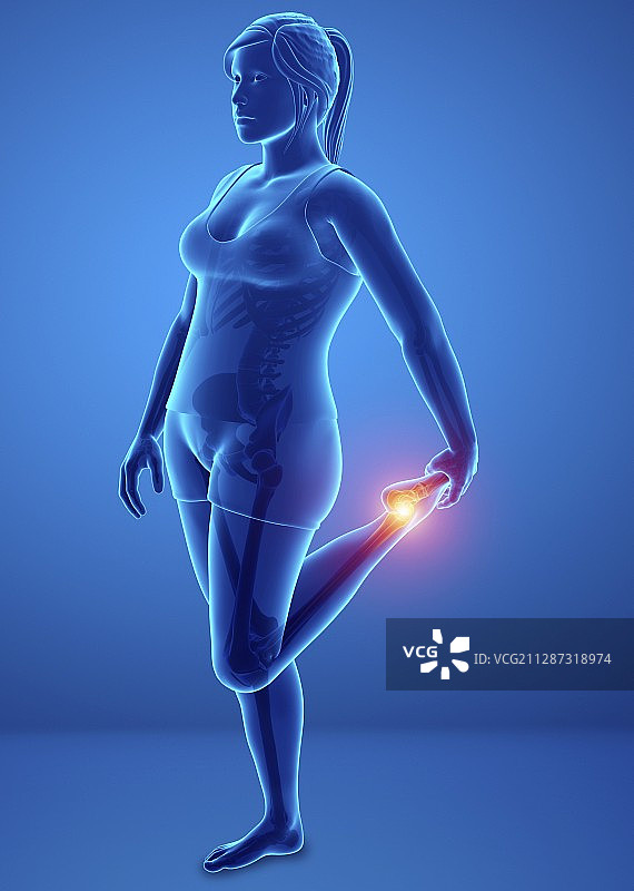 脚痛的女人，插图图片素材