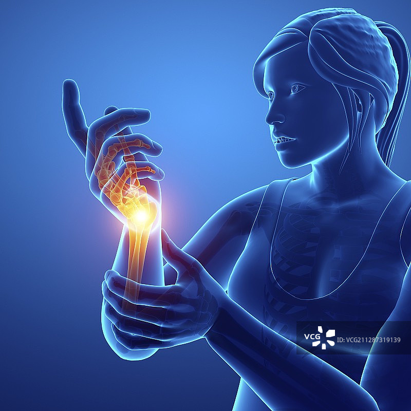 手腕疼痛的女人，插图图片素材