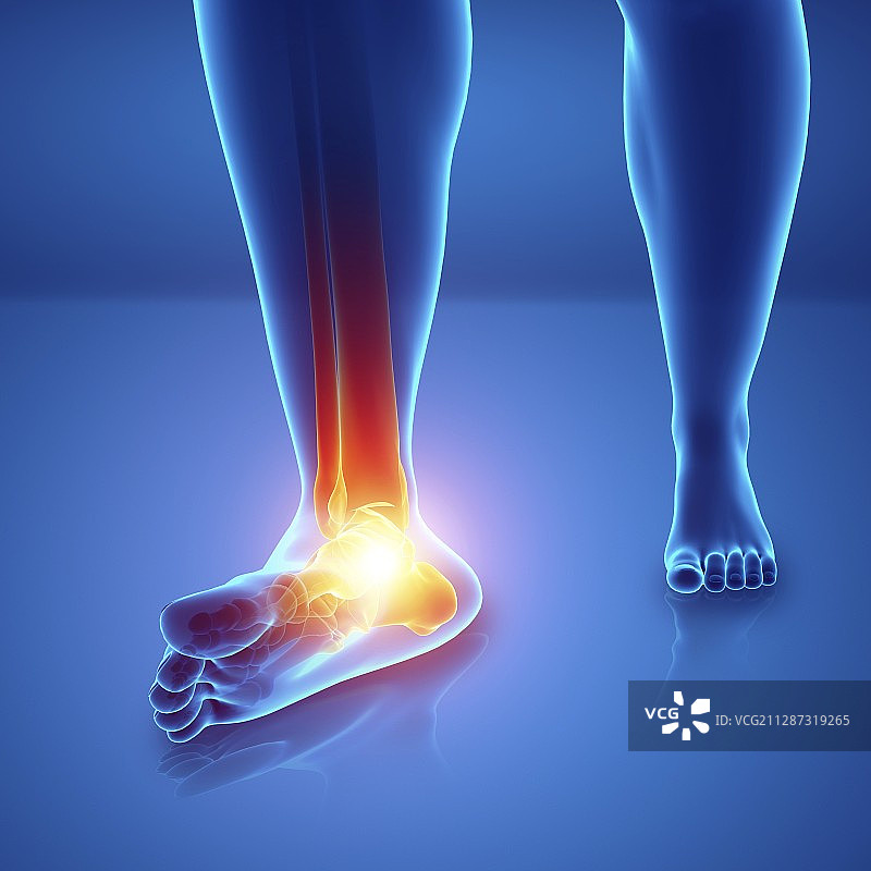脚痛的男人插画图片素材