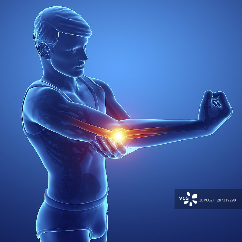 肘部疼痛的男人，插图图片素材