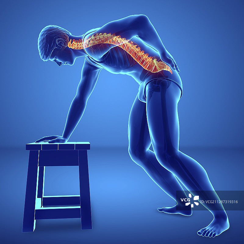 背痛的男人，插图图片素材