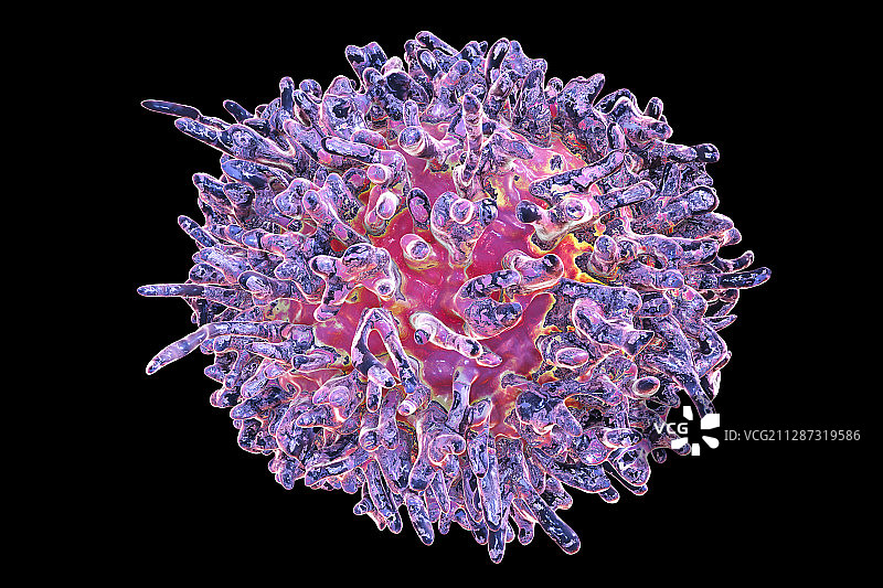 毛细胞白血病中的淋巴细胞，图示图片素材