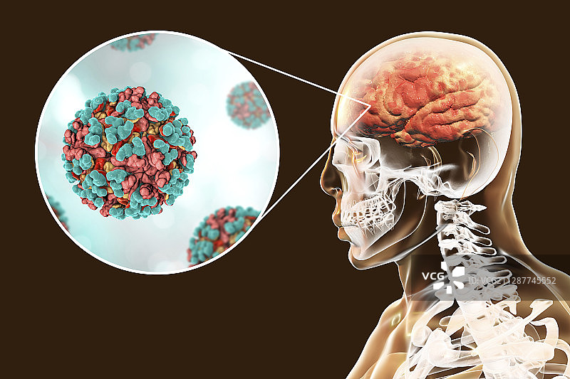 感染人脑的脑炎病毒，图示图片素材