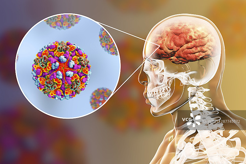 感染人脑的脑炎病毒，图示图片素材