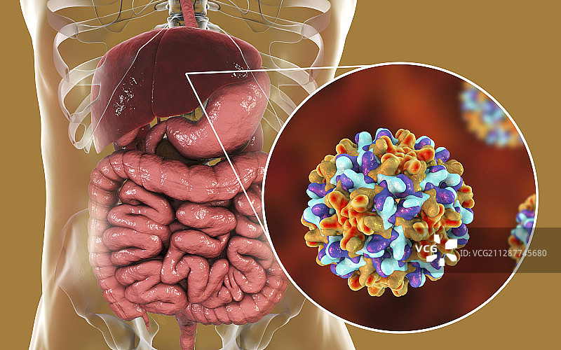 乙型肝炎病毒感染，图示图片素材