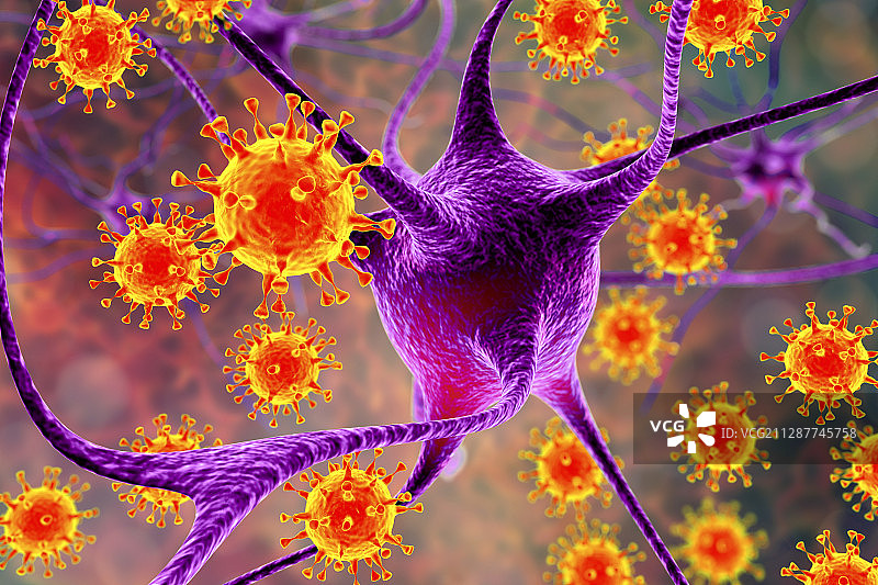 病毒性脑炎，插图图片素材