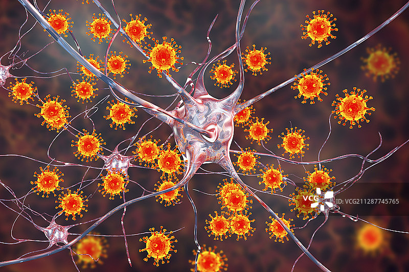 病毒性脑炎，插图图片素材