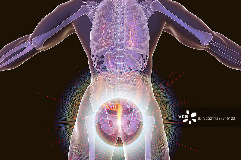 痔疮插图图片素材