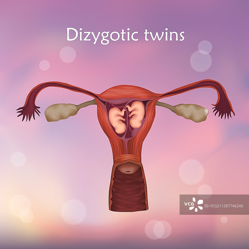 异卵双胞胎插画图片素材