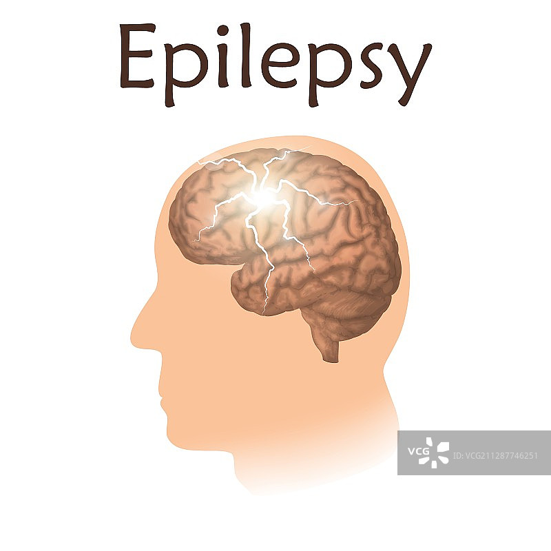 癫痫插画图片素材