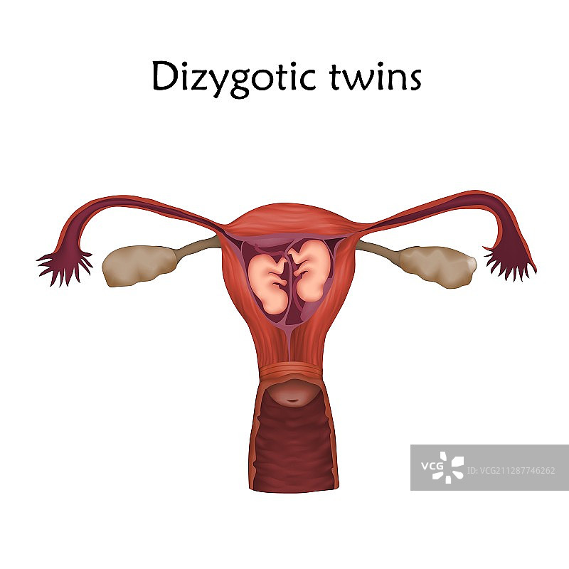 异卵双胞胎插画图片素材