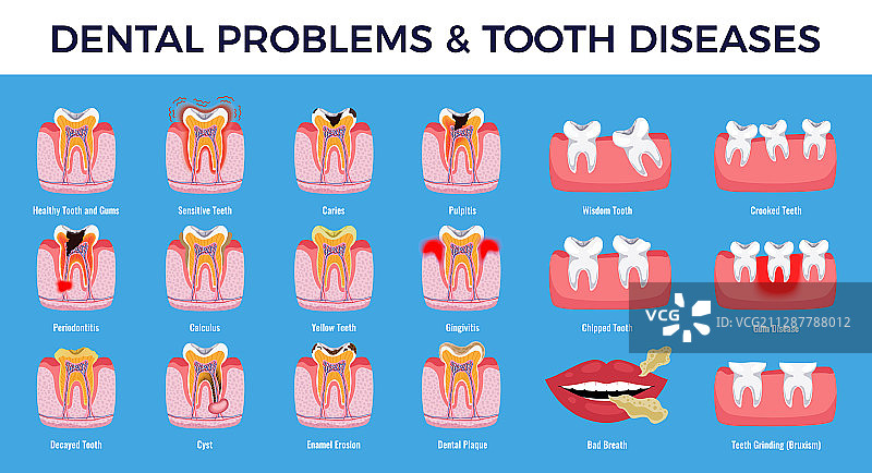 牙科疾病问题信息图图片素材