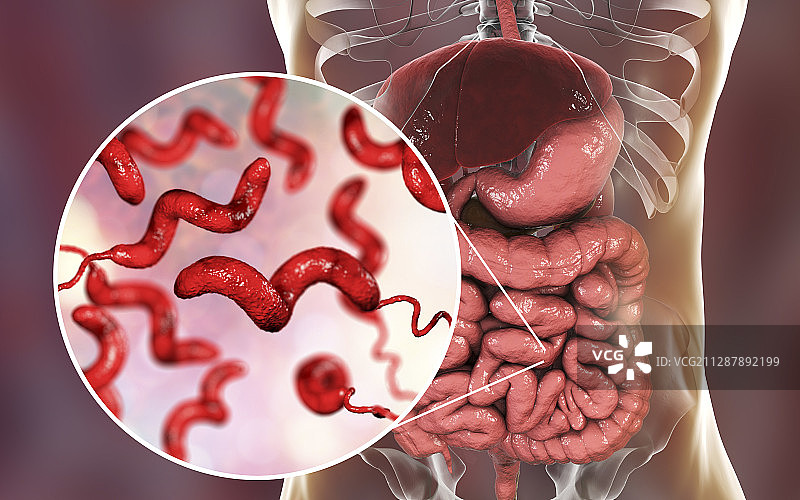 弯曲杆菌病概念图图片素材