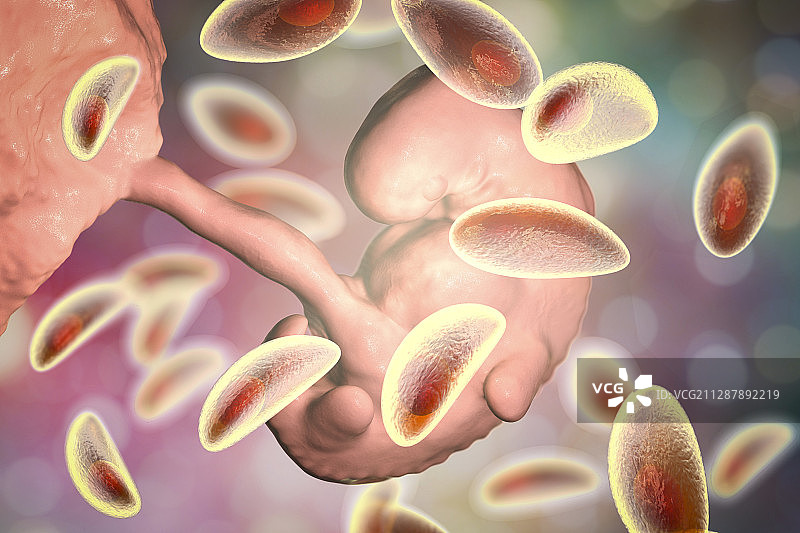 弓形虫病的胎盘传播示意图图片素材