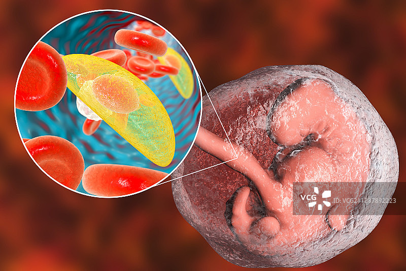 弓形虫病的胎盘传播示意图图片素材