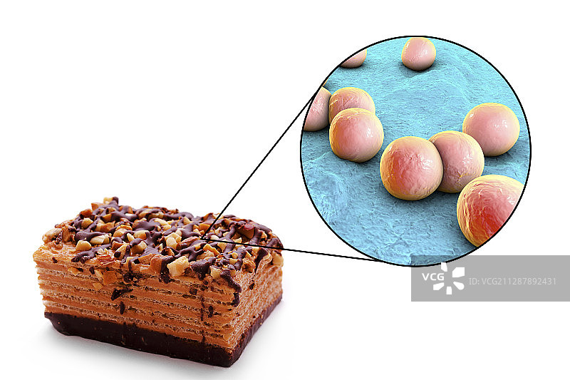 葡萄球菌食物中毒概念图图片素材