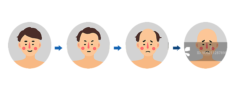 男性脱发图片素材