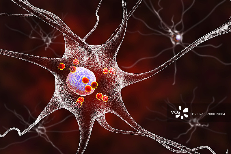 帕金森病神经细胞插图图片素材