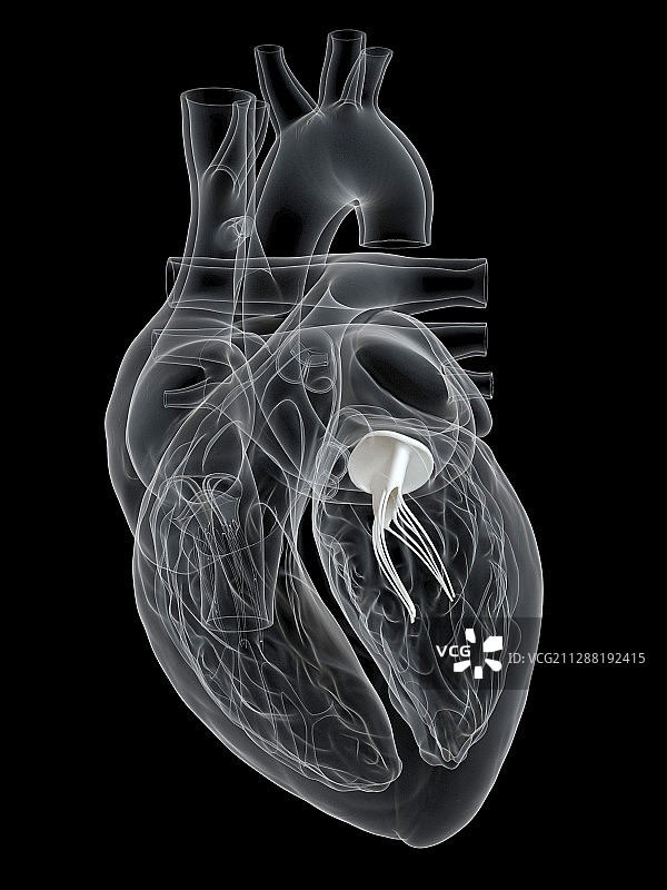 人类心脏二尖瓣插图图片素材