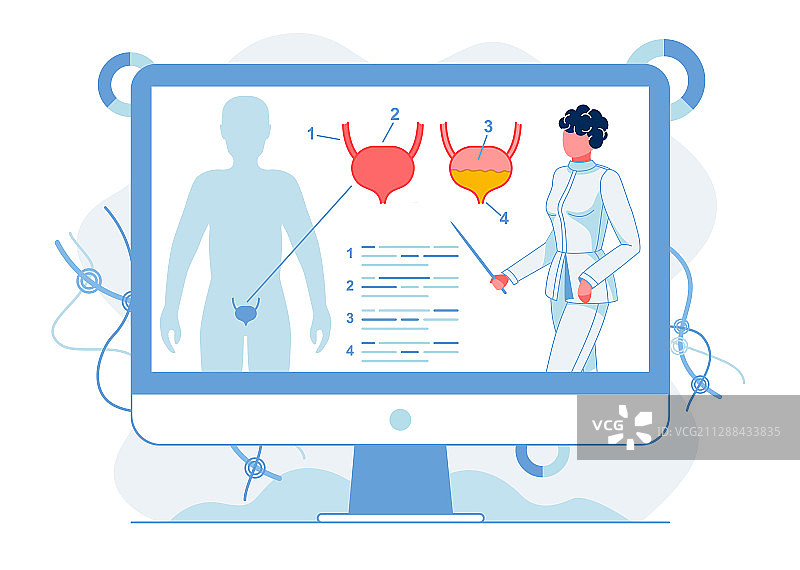 人体膀胱解剖结构扁平图图片素材