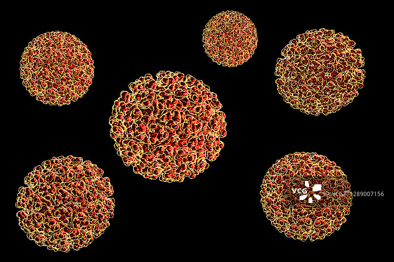 罗斯河病毒，图示图片素材