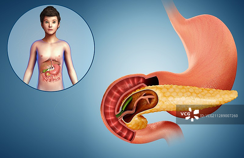 儿童的胰腺和十二指肠插图图片素材