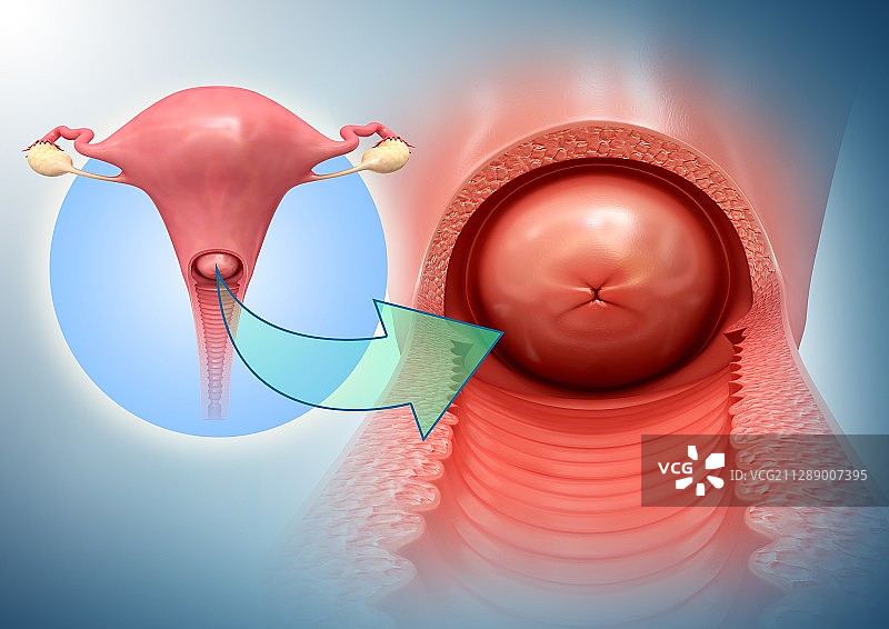 女性生殖系统插图图片素材