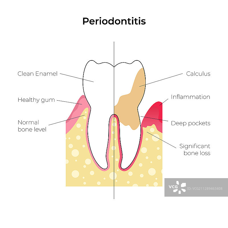 独立牙齿图片素材