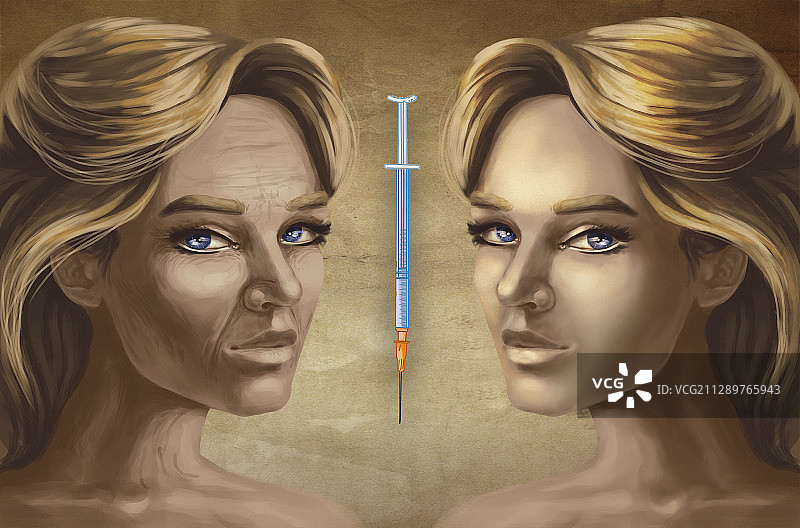 整形手术插图图片素材