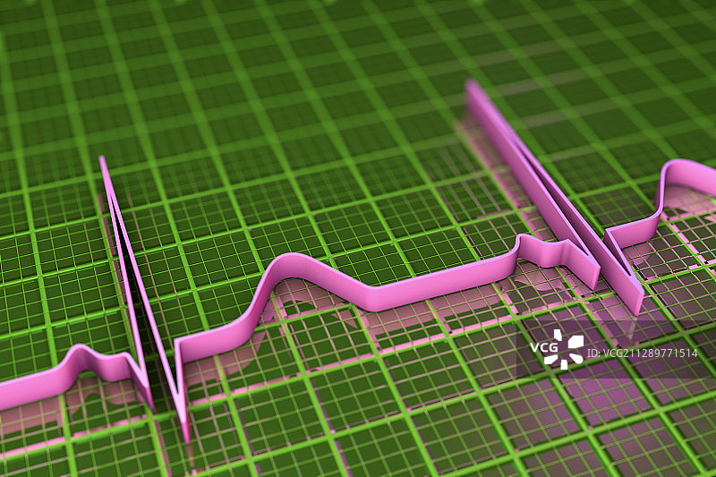 心电图，插图图片素材