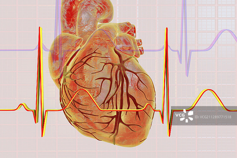 正常心跳示意图图片素材