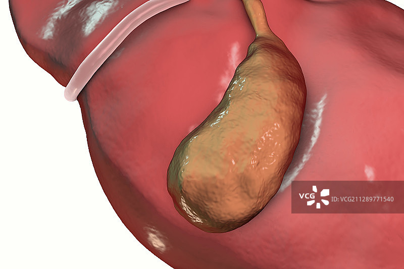 健康的胆囊插画图片素材