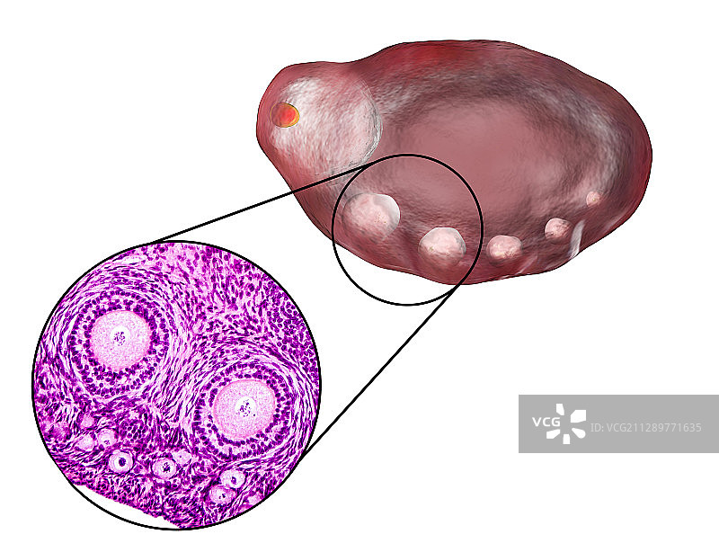卵巢卵泡显微照片和插图图片素材