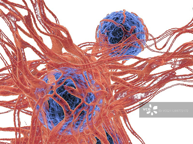 癌症细胞,说明图片素材