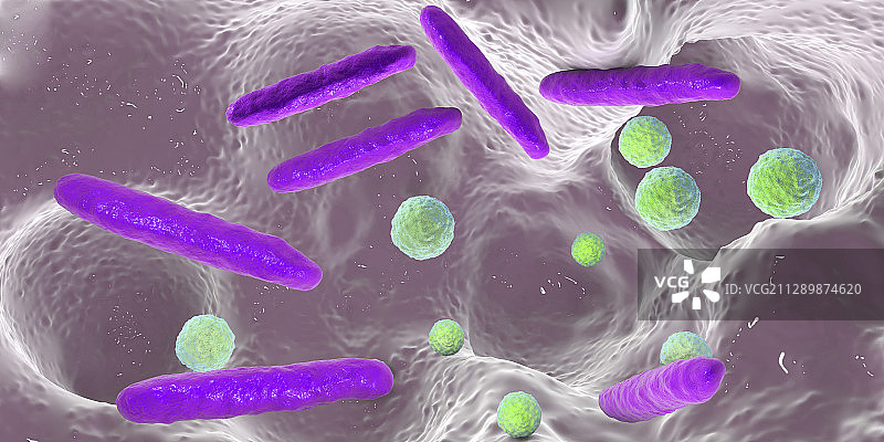 牙洞内的细菌，图示图片素材