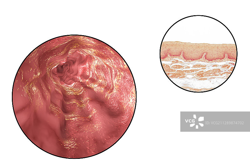 食管壁，光镜照片与插图图片素材