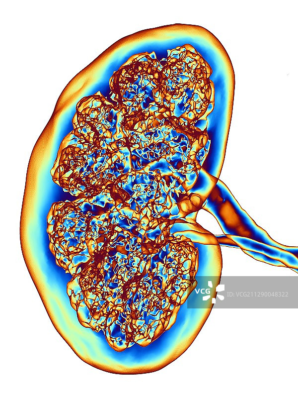 肾脏，CT扫描图片素材