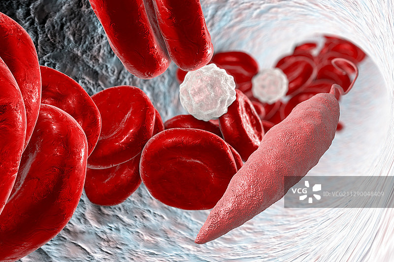 血液中的利什曼原虫，图示图片素材