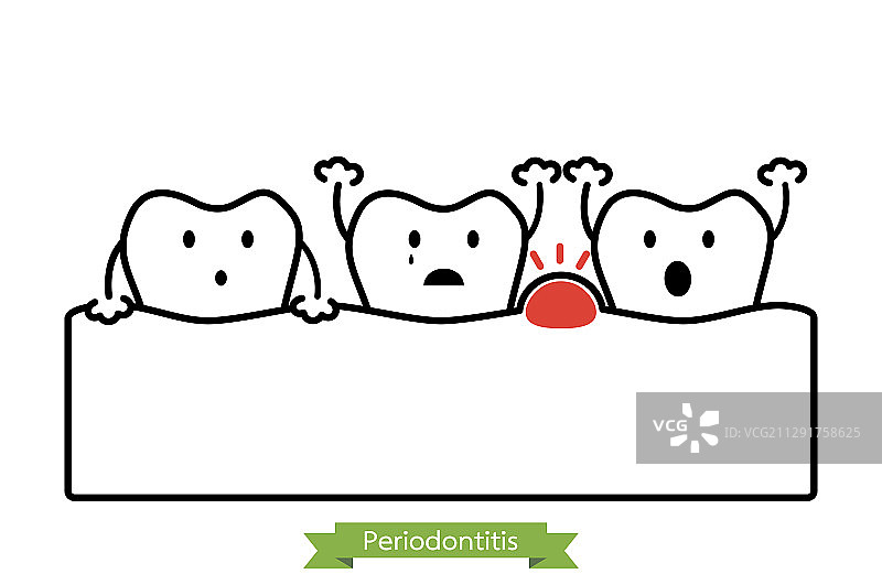 牙周炎或牙龈肿胀图片素材
