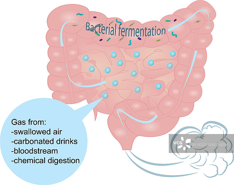 肠道胀气和过量气体图片素材