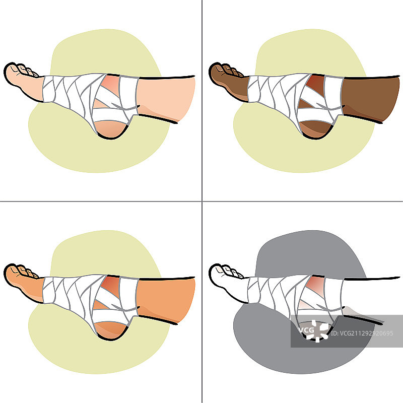 急救人员包扎脚部侧视图图片素材