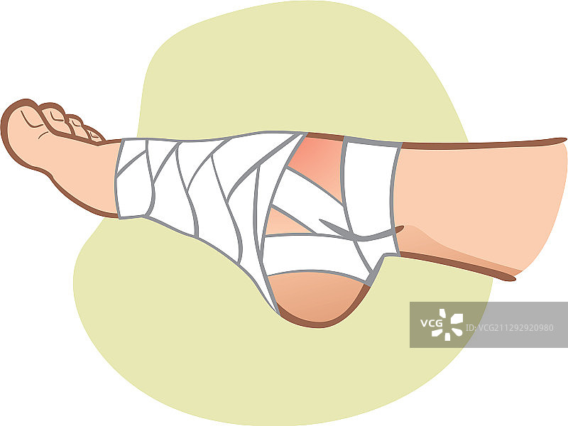 包扎着脚部的白人男子侧面图图片素材