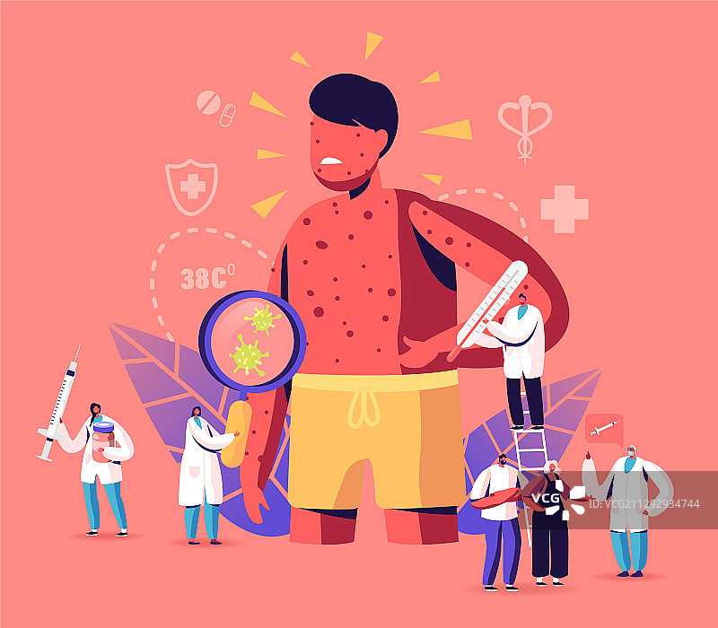 水痘症状概念图图片素材