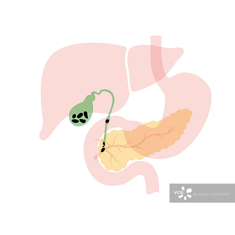 胰腺和胆囊图片素材
