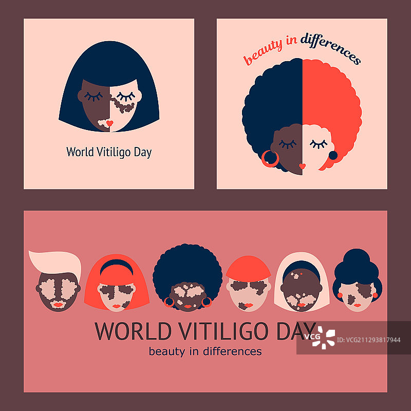 白癜风海报图片素材