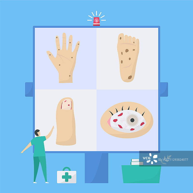 心脏病学：这种疾病是心内膜炎或心脏病图片素材