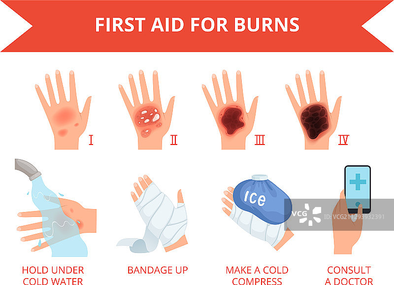 烧伤皮肤急救处理图片素材