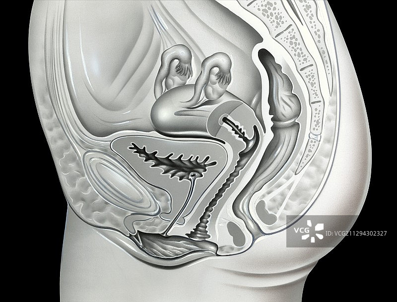 女性泌尿生殖区域，图示图片素材