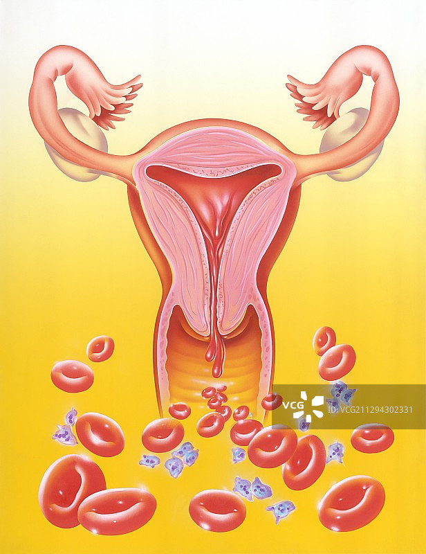 月经量过多示意图图片素材